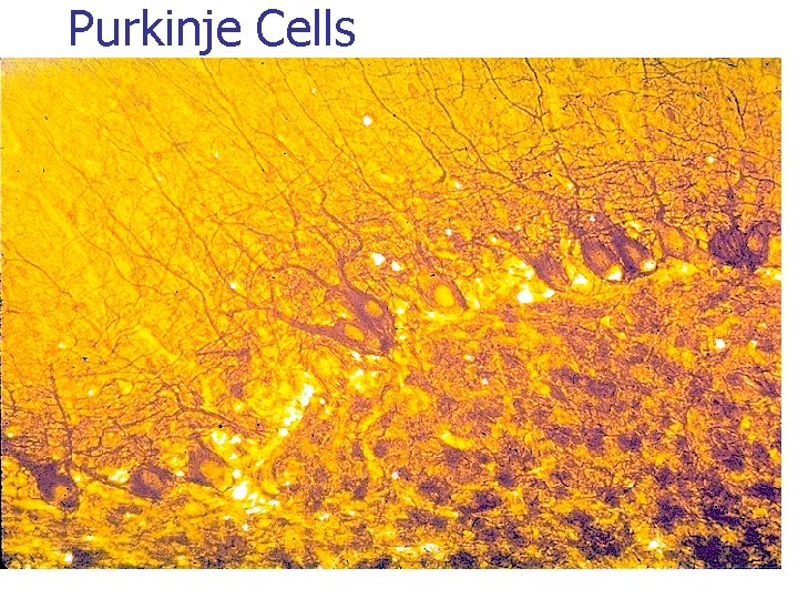 Purkinje Cells 