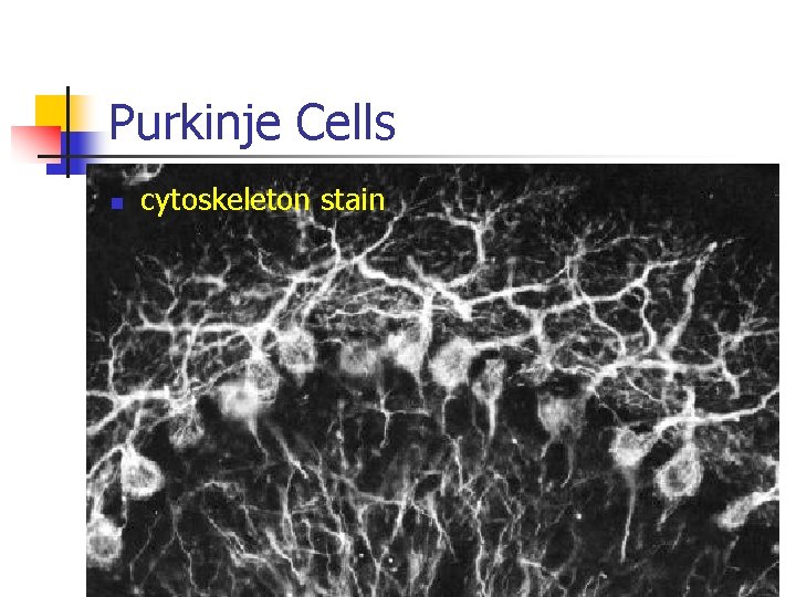Purkinje Cells n cytoskeleton stain 