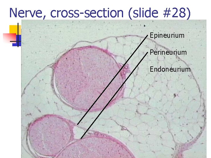 Nerve, cross-section (slide #28) Epineurium Perineurium Endoneurium 