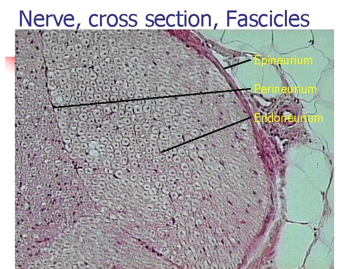 Nerve, cross section, Fascicles Epineurium Perineurium Endoneurium 
