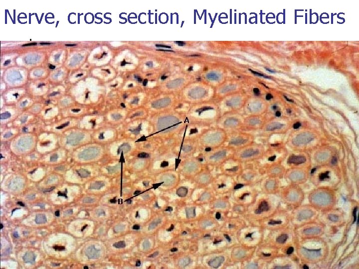 Nerve, cross section, Myelinated Fibers 