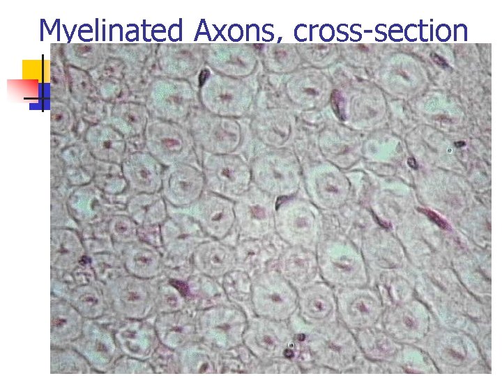 Myelinated Axons, cross-section 