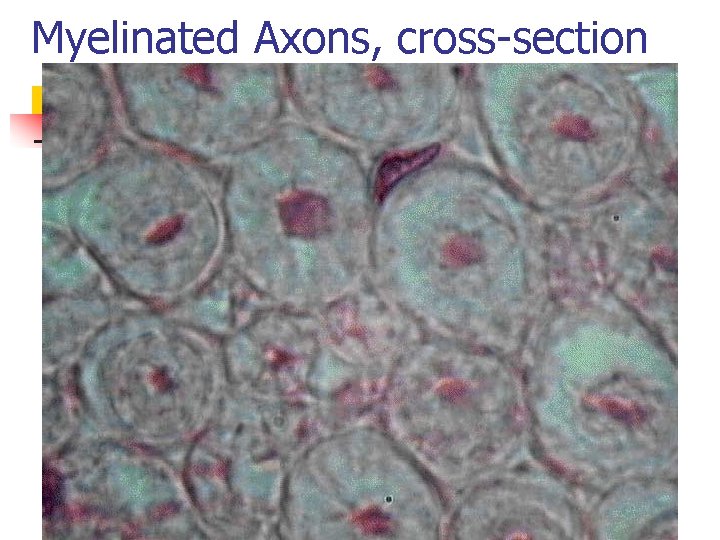 Myelinated Axons, cross-section 