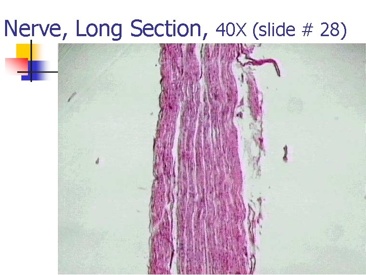 Nerve, Long Section, 40 X (slide # 28) 
