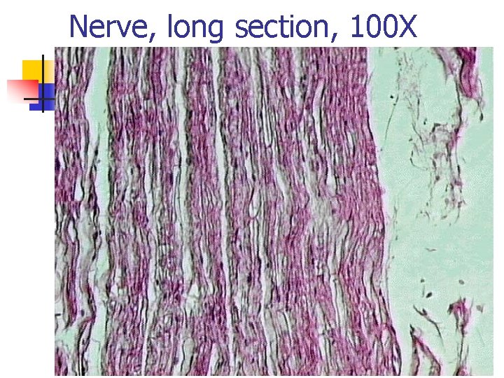Nerve, long section, 100 X 