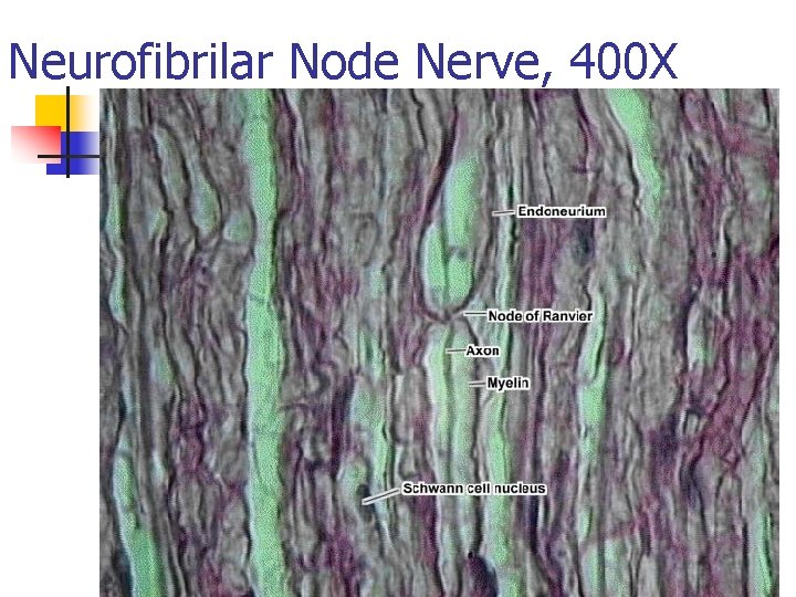Neurofibrilar Node Nerve, 400 X 