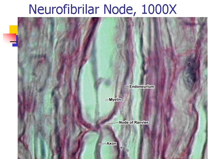 Neurofibrilar Node, 1000 X 
