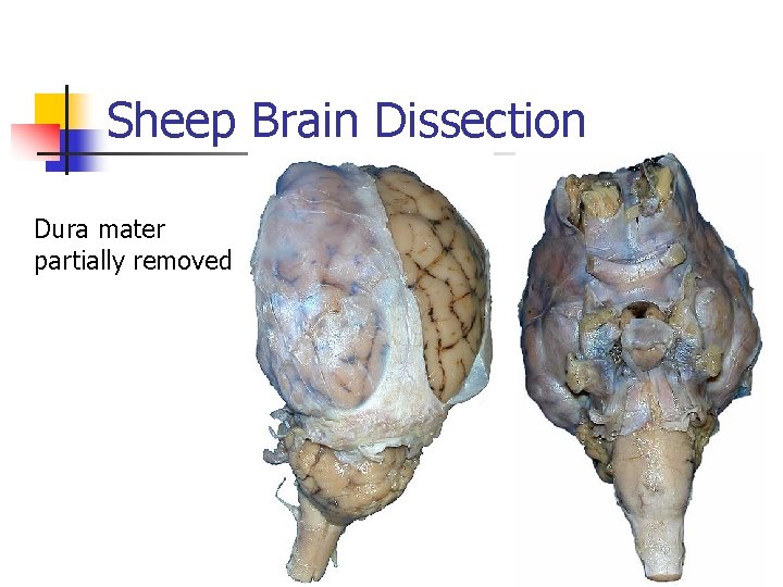 Sheep Brain Dissection Dura mater partially removed 