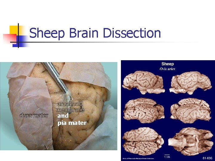 Sheep Brain Dissection and pia mater 