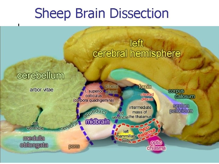 Sheep Brain Dissection 