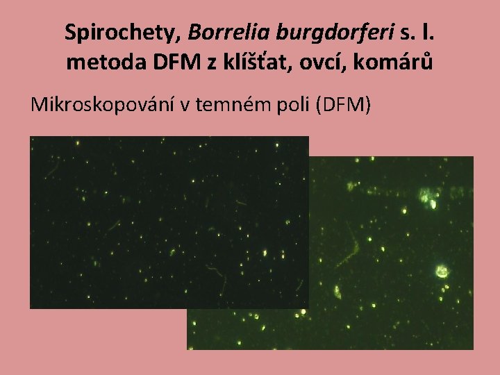 Spirochety, Borrelia burgdorferi s. l. metoda DFM z klíšťat, ovcí, komárů Mikroskopování v temném