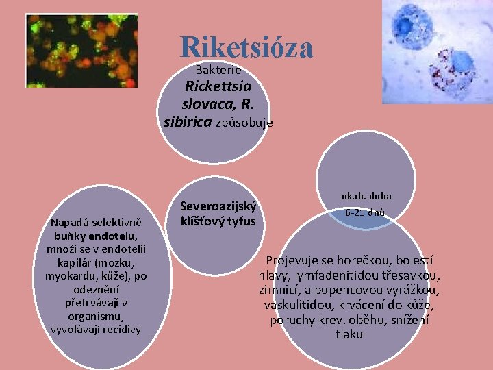 Riketsióza Bakterie Rickettsia slovaca, R. sibirica způsobuje Napadá selektivně buňky endotelu, množí se v