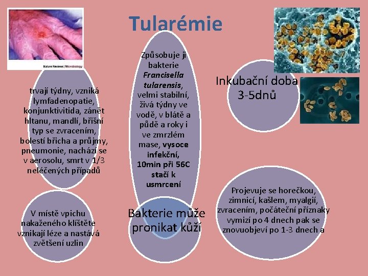 Tularémie trvají týdny, vzniká lymfadenopatie, konjunktivitida, zánět hltanu, mandlí, břišní typ se zvracením, bolestí