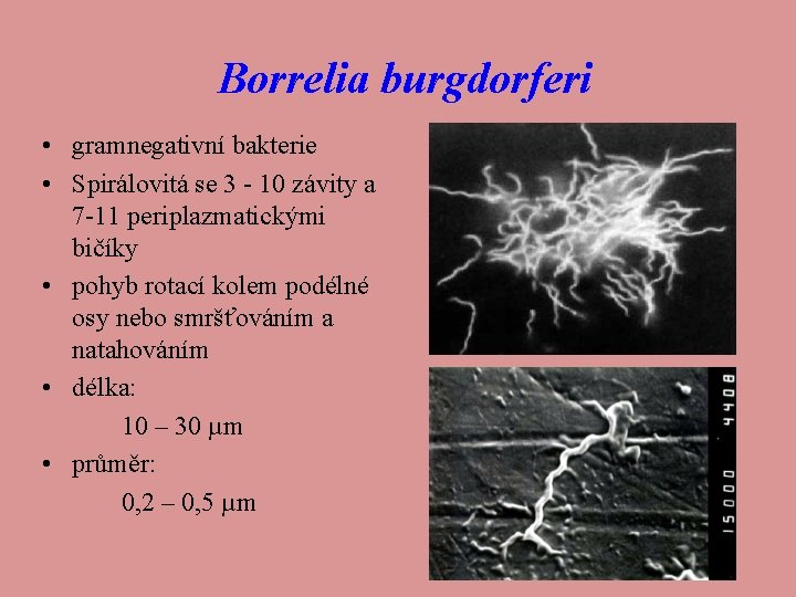 Borrelia burgdorferi • gramnegativní bakterie • Spirálovitá se 3 - 10 závity a 7