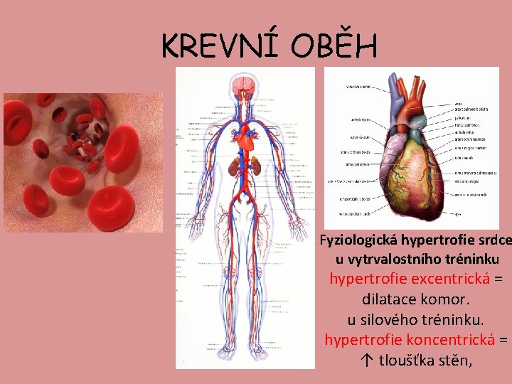 KREVNÍ OBĚH Fyziologická hypertrofie srdce u vytrvalostního tréninku hypertrofie excentrická = dilatace komor. u