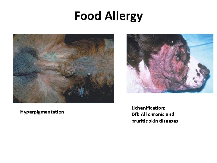Food Allergy Hyperpigmentation Lichenification: Dff: All chronic and pruritic skin diseases Food Allergy Hyperpigmentation Lichenification: Dff: All chronic and pruritic skin diseases