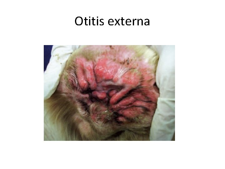 Otitis externa 