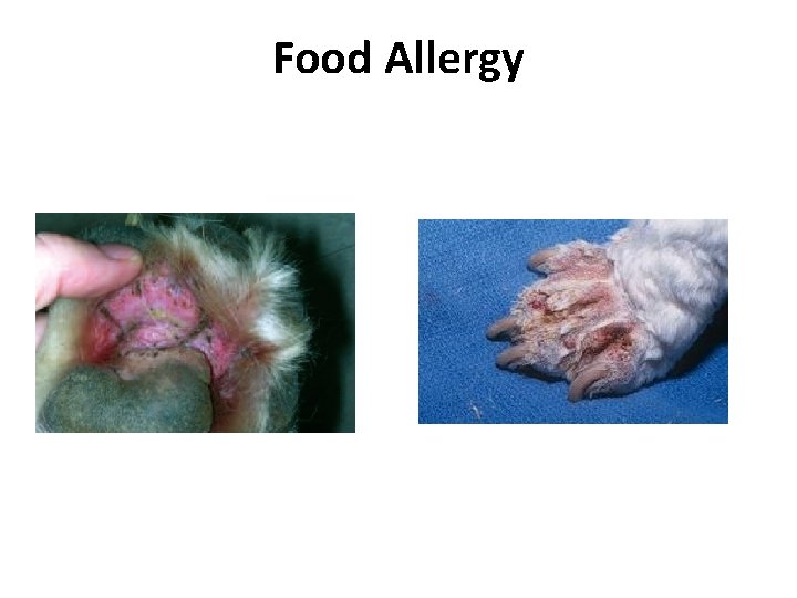 Food Allergy 