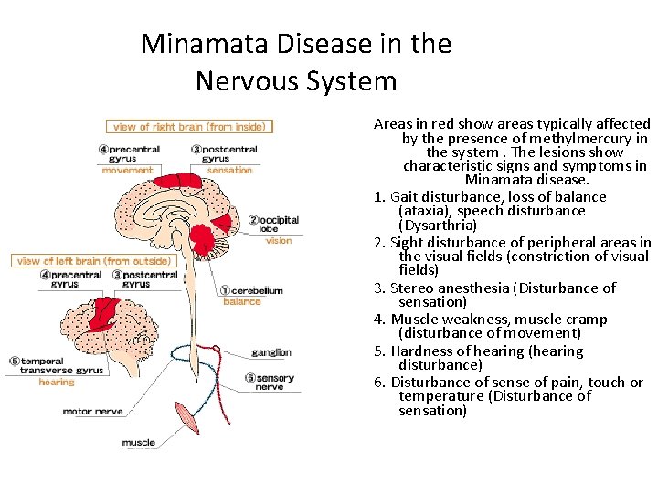 Minamata Disease in the Nervous System Areas in red show areas typically affected by