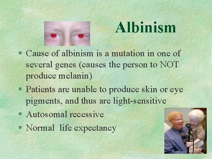 Albinism § Cause of albinism is a mutation in one of several genes (causes