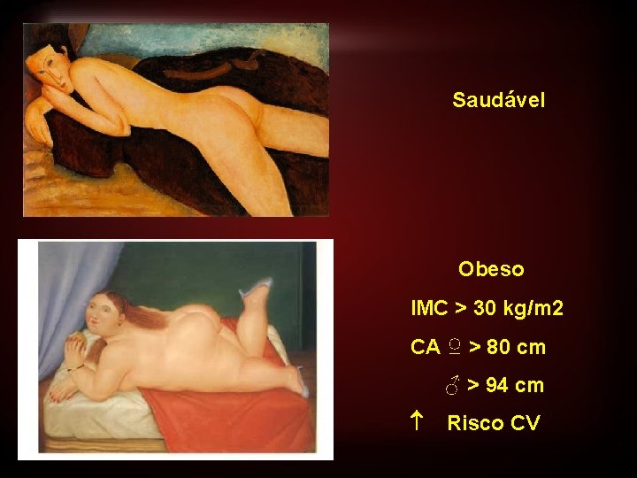 Saudável Obeso IMC > 30 kg/m 2 CA ♀ > 80 cm ♂ >