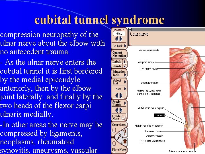 cubital tunnel syndrome compression neuropathy of the ulnar nerve about the elbow with no