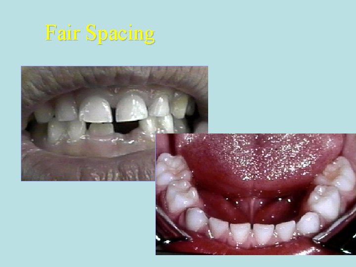 Fair Spacing Fair Spacing