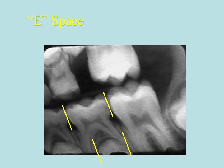 “E” Space “E” Space