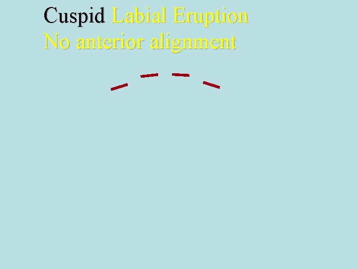 Cuspid Labial Eruption No anterior alignment 