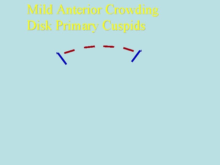 Mild Anterior Crowding Disk Primary Cuspids 