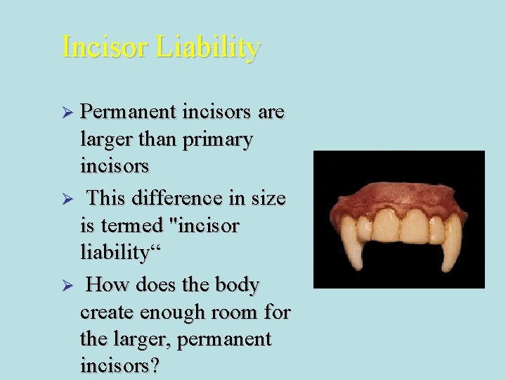 Incisor Liability Ø Permanent incisors are larger than primary incisors Ø This difference in