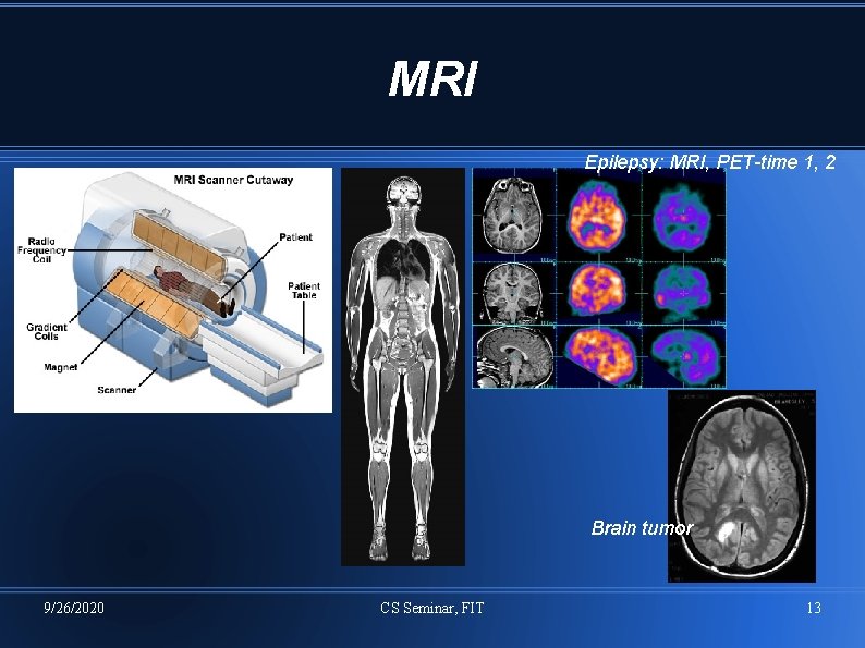 MRI Epilepsy: MRI, PET-time 1, 2 Brain tumor 9/26/2020 CS Seminar, FIT 13 