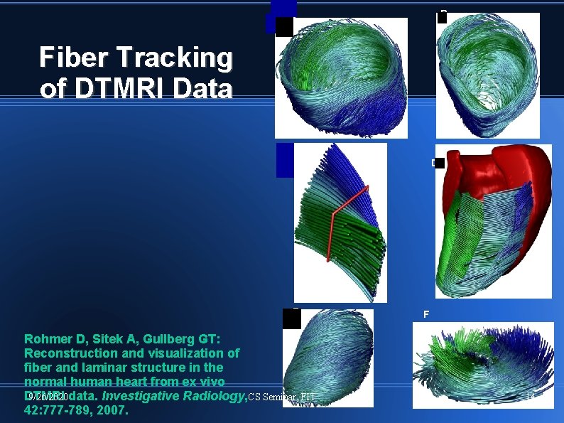 A B Fiber Tracking of DTMRI Data C D E Rohmer D, Sitek A,