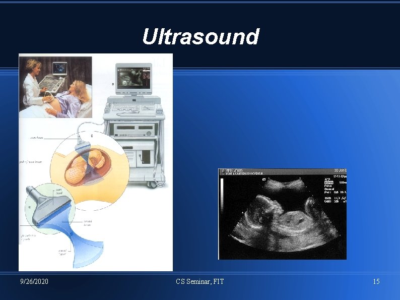 Ultrasound 9/26/2020 CS Seminar, FIT 15 