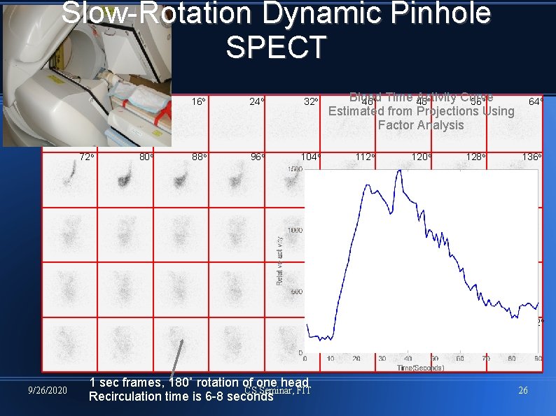 Slow-Rotation Dynamic Pinhole SPECT 0 o 72 o 8 o 16 o 24 o