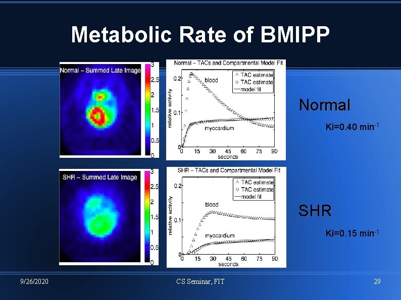 Metabolic Rate of BMIPP Normal Ki=0. 40 min-1 SHR Ki=0. 15 min-1 9/26/2020 CS