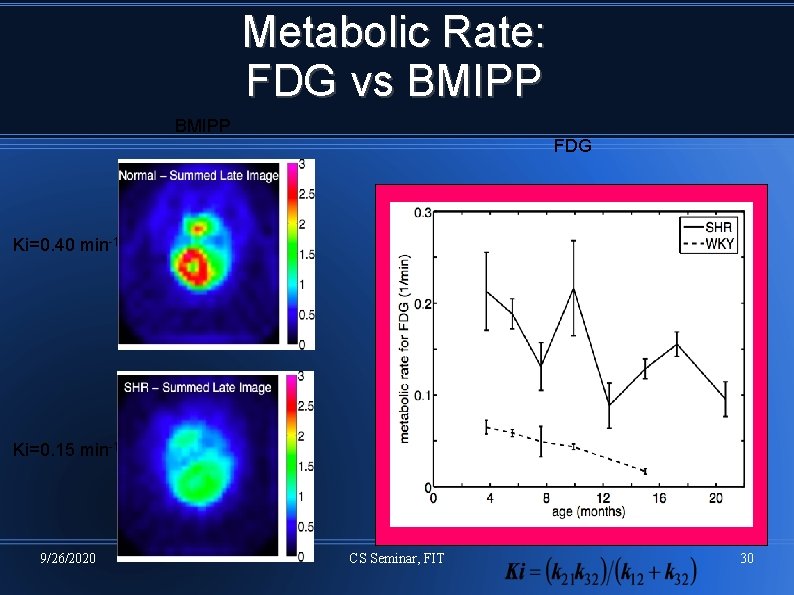 Metabolic Rate: FDG vs BMIPP FDG Ki=0. 40 min-1 Ki=0. 15 min-1 9/26/2020 CS