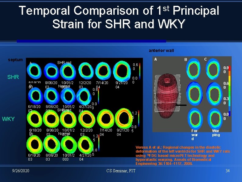 Temporal Comparison of 1 st Principal Strain for SHR and WKY anterior wall septum