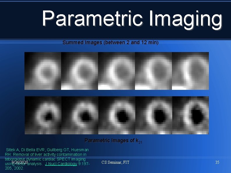 Parametric Imaging Summed Images (between 2 and 12 min) Parametric Images of k 21