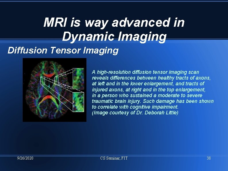 MRI is way advanced in Dynamic Imaging Diffusion Tensor Imaging A high-resolution diffusion tensor