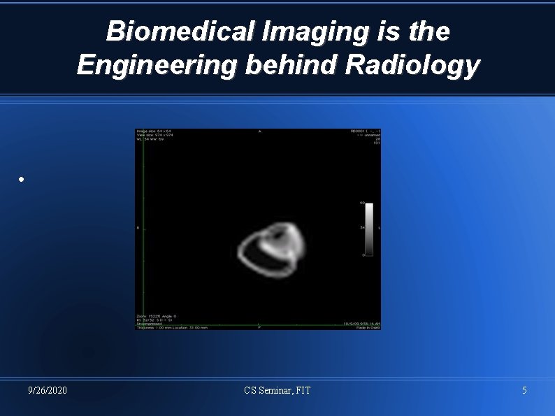 Biomedical Imaging is the Engineering behind Radiology • 9/26/2020 CS Seminar, FIT 5 