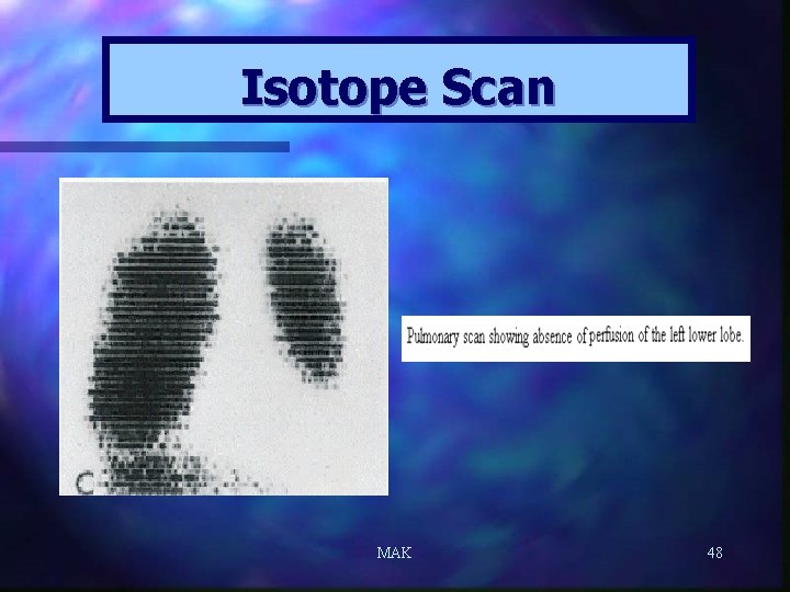 Isotope Scan MAK 48 