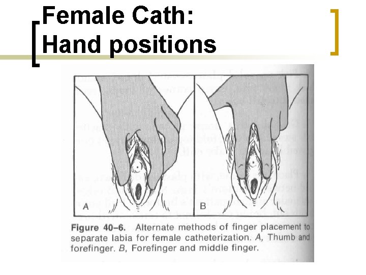 Female Cath: Hand positions 