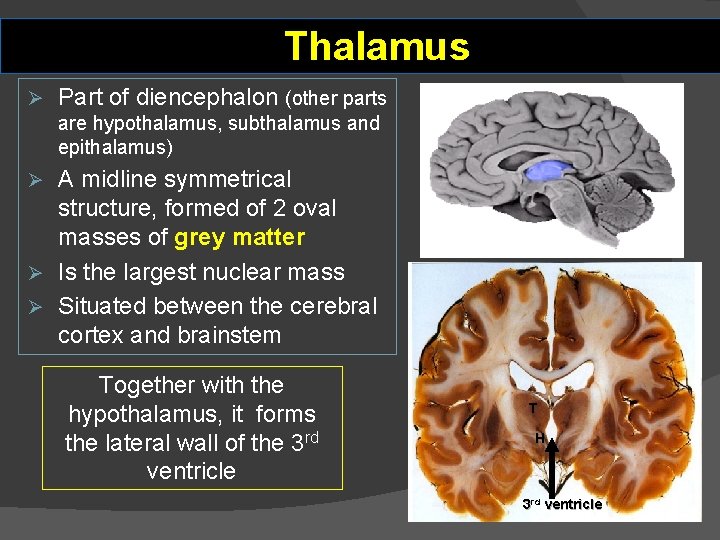 Thalamus Ø Part of diencephalon (other parts are hypothalamus, subthalamus and epithalamus) A midline