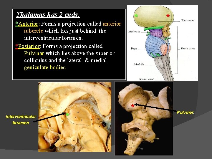 Thalamus has 2 ends. *Anterior: Forms a projection called anterior tubercle which lies just