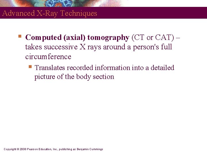 Advanced X-Ray Techniques § Computed (axial) tomography (CT or CAT) – takes successive X