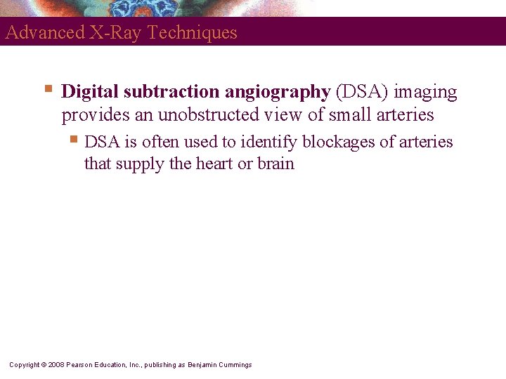 Advanced X-Ray Techniques § Digital subtraction angiography (DSA) imaging provides an unobstructed view of