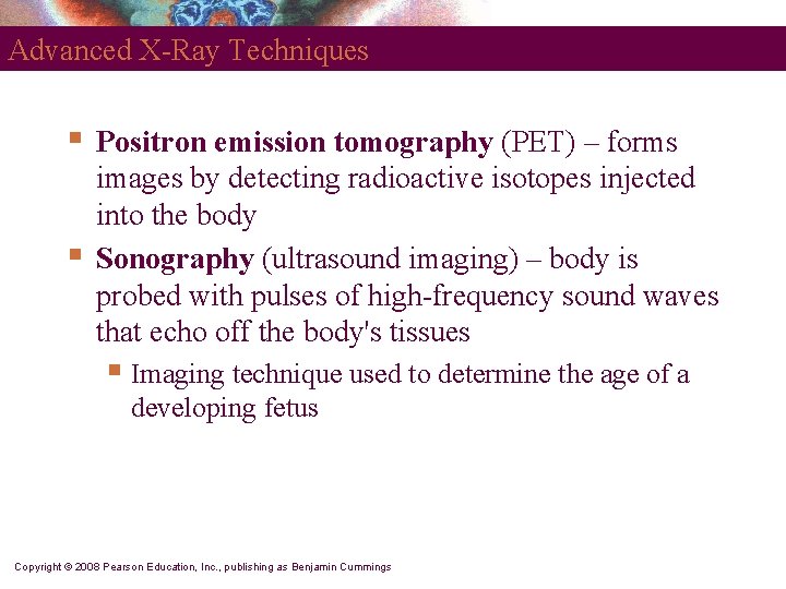 Advanced X-Ray Techniques § § Positron emission tomography (PET) – forms images by detecting