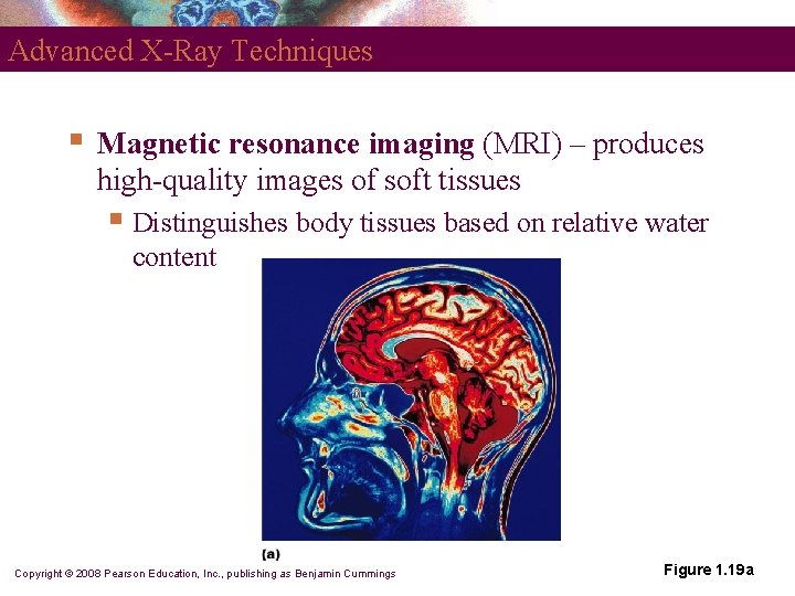 Advanced X-Ray Techniques § Magnetic resonance imaging (MRI) – produces high-quality images of soft