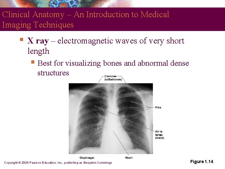 Clinical Anatomy – An Introduction to Medical Imaging Techniques § X ray – electromagnetic